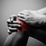Retropatellararthrose im Knie - Symptome und Ursachen