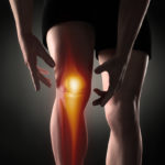 Bone Bruise Knie - Therapie, Symptome und Heilungsdauer