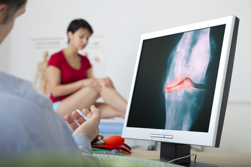 Mediale Gonarthrose im Knie - Therapie, Folgen