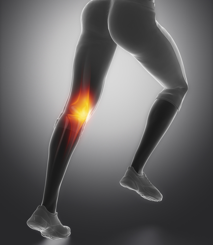 Reizerguss im Knie - Symptome, Therapie, Behandlung