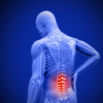 Ziehen im unteren Rücken - Ursachen, Diagnose und Therapie
