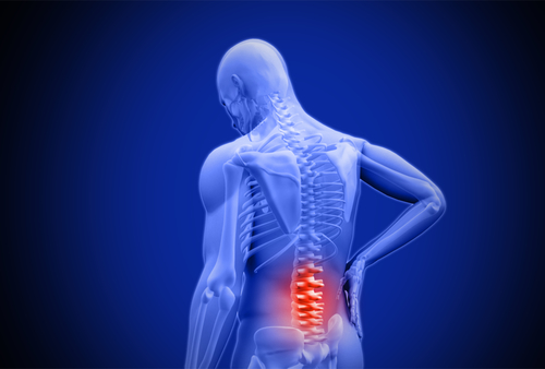 Ziehen im unteren Rücken - Ursachen, Diagnose und Therapie