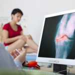 Kniegelenkspalt - Arzt erklärt die Anatomie
