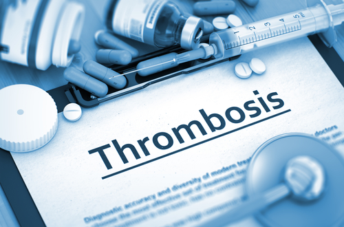 Thrombosespritze – wie anwenden
