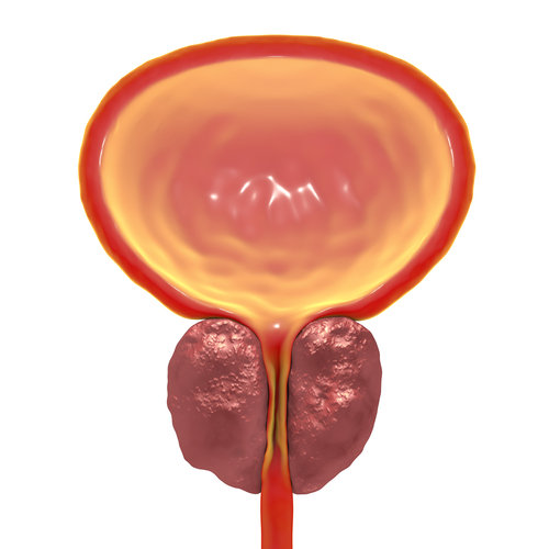 Prostatahypertrophie – Behandlung und Therapie