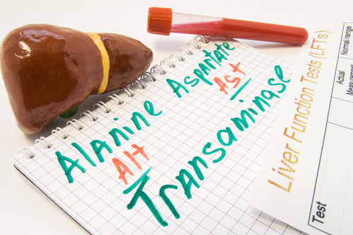 Transaminasenerhöhung – richtige Diagnose ist sehr wichtig