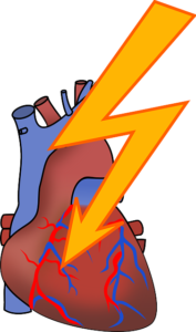 Kardiogenerschock – Ursachen, Behandlung und Therapie