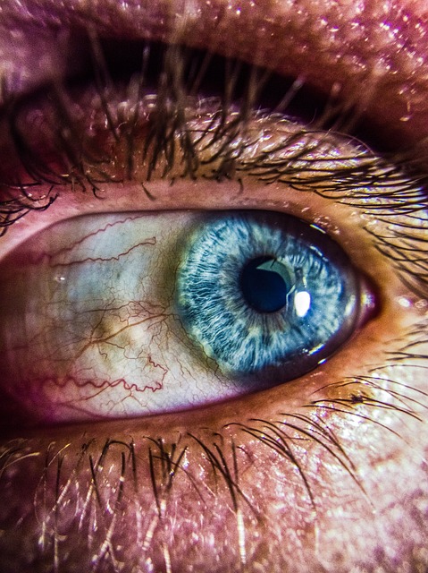 Iridozyklitis – Diagnostik, Symptome, Ursachen und Behandlung