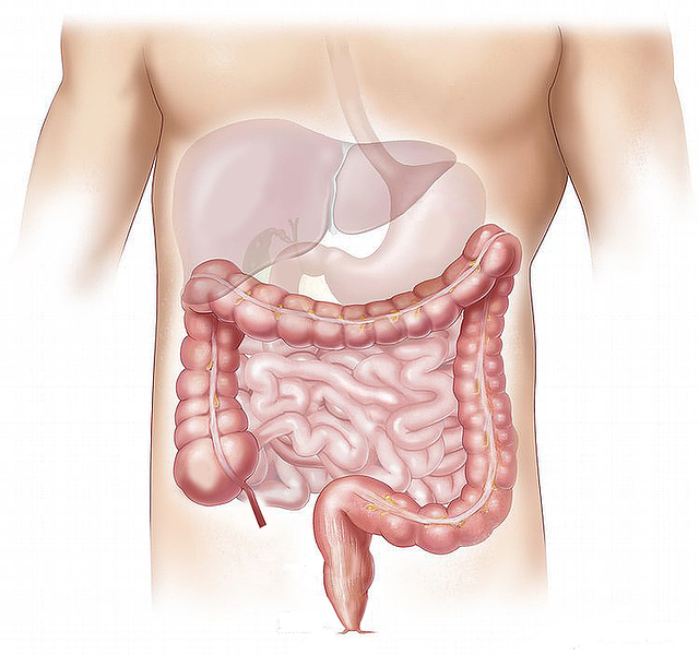 Bridenileus – Entstehung, Symptome und Behandlung