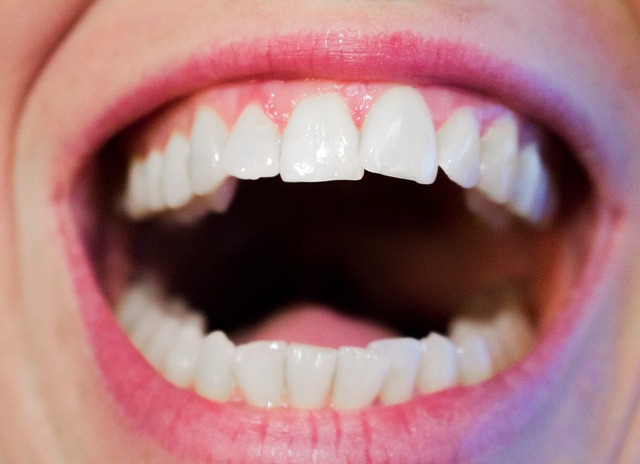 Sialolithiasis – Definition, Ursachen und Symptome