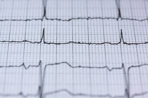 Herzuntersuchung – Regelmäßige Herz-Checks sind notwendig
