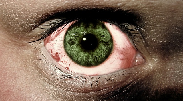 Chlamydien im Auge – Ursachen, Symptome und Behandlung