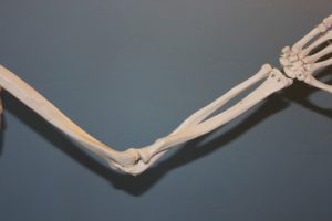 Elle Knochen – Was erfolgt wenn der Arm gebrochen ist?
