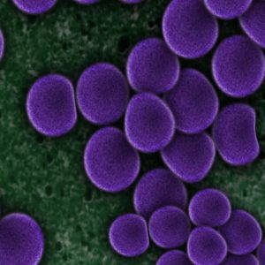 Bakterieller Infekt – Ursachen und Diagnose