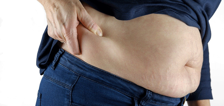 Information zu dem Ablauf einer Bauchstraffung